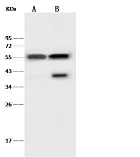 DES / Desmin Antibody - Anti-DES rabbit polyclonal antibody at 1:500 dilution. Lane A: Mouse muscle tissue lysate. Lane B: Mouse heart tissue lysate. Lysates/proteins at 30 ug per laneSecondaryGoat Anti-Rabbit IgG (H+L)/HRP at 1/10000 dilution. Developed using the ECL technique. Performed under reducing conditions. Predicted band size: 54 kDa. Observed band size: 55 kDa.