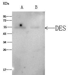 DES / Desmin Antibody - DES was immunoprecipitated using: Lane A: 0.5 mg Mouse heart tissue ysate Whole Cell Lysate. Lane B: 0.5 mg A431 Whole Cell Lysate. 4 uL anti-DES rabbit polyclonal antibody and 60 ug of Immunomagnetic beads Protein A/G. Primary antibody: Anti-DES rabbit polyclonal antibody, at 1:100 dilution. Secondary antibody: Clean-Blot IP Detection Reagent (HRP) at 1:1000 dilution. Developed using the ECL technique. Performed under reducing conditions. Predicted band size: 54 kDa. Observed band size: 55 kDa.