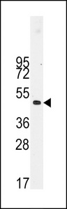 DES / Desmin Antibody - Western blot of anti-Desmin Antibody (t16) in NCI-H460 cell line lysates (35 ug/lane). Desmin-pT16(arrow) was detected using the purified antibody.