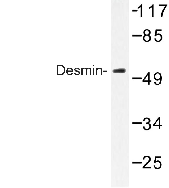 DES / Desmin Antibody - Western blot of Desmin (V56) pAb in extracts from HeLa cells.