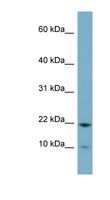 DESI1 / PPPDE2 Antibody - PPPDE2 antibody Western blot of OVCAR-3 cell lysate. This image was taken for the unconjugated form of this product. Other forms have not been tested.