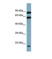 DESI2 / PPPDE1 Antibody - Western blot of Human PANC1 Whole cell . DESI2 antibody dilution 1.0 ug/ml.  This image was taken for the unconjugated form of this product. Other forms have not been tested.