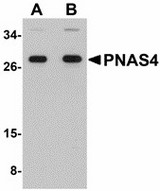 DESI2 / PPPDE1 Antibody - Western blot of PNAS4 in EL4 cell lysate with PNAS4 antibody at (A) 1 and (B) 2 ug/ml.