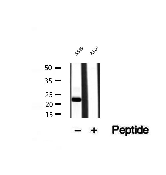 DESI2 / PPPDE1 Antibody - Western blot analysis of extracts of A549 cells using PPPDE1/PNAS4 antibody.
