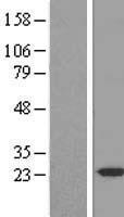 DESI2 / PPPDE1 Protein - Western validation with an anti-DDK antibody * L: Control HEK293 lysate R: Over-expression lysate