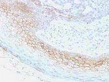 Desmocollin 2+3 Antibody - IHC testing of FFPE human skin with Desmocollin 2/3 antibody (clone 7G6). Required HIER: boil tissue sections in 10mM Tris with 1mM EDTA, pH 9, for 10-20 min.