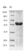 DNA Ligase Protein - (Tris-Glycine gel) Discontinuous SDS-PAGE (reduced) with 5% enrichment gel and 15% separation gel.