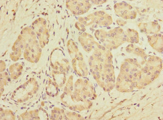 DET1 Antibody - Immunohistochemistry of paraffin-embedded human pancreatic tissue at dilution 1:100