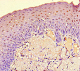 DET1 Antibody - Immunohistochemistry of paraffin-embedded human tonsil tissue at dilution of 1:100