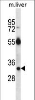 Dexras1 / RASD1 Antibody - RASD1 Antibody western blot of mouse liver tissue lysates (35 ug/lane). The RASD1 antibody detected the RASD1 protein (arrow).
