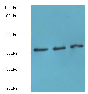 DFFA / ICAD / DFF45 Antibody - Western blot. All lanes: DFFA antibody at 10 ug/ml. Lane 1: HeLa whole cell lysate. Lane 2: 293T whole cell lysate. Lane 3: PC-3 whole cell lysate. Secondary antibody: Goat polyclonal to rabbit at 1:10000 dilution. Predicted band size: 37 kDa. Observed band size: 37 kDa.
