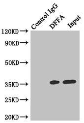 DFFA / ICAD / DFF45 Antibody - Immunoprecipitating DFFA in Hela whole cell lysate Lane 1: Rabbit monoclonal IgG (1µg) instead of DFFA Antibody in Hela whole cell lysate.For western blotting, a HRP-conjugated anti-rabbit IgG, specific to the non-reduced form of IgG was used as the Secondary antibody (1/50000) Lane 2: DFFA Antibody (4µg) + Hela whole cell lysate (500µg) Lane 3: Hela whole cell lysate (20µg)