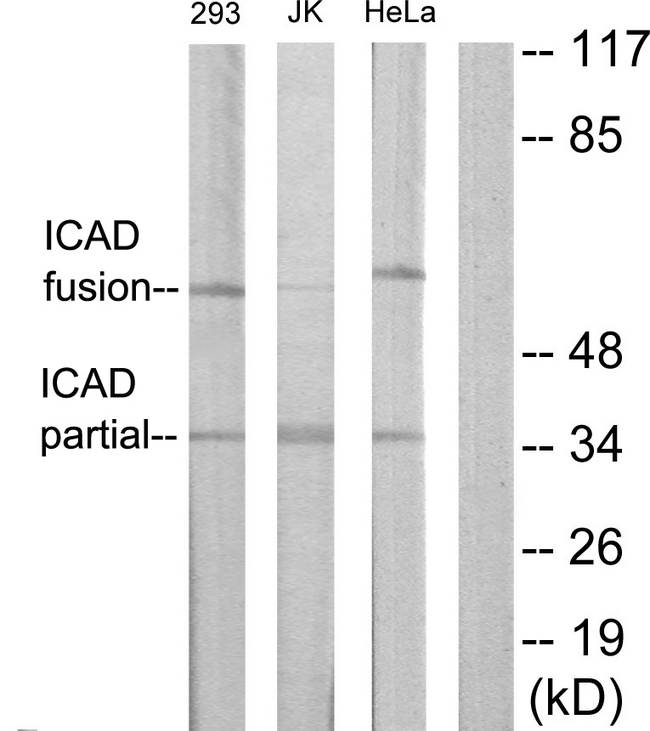 DFFA / ICAD / DFF45 Antibody - Western blot analysis of lysates from Jurkat, 293, and HeLa cells, using DFFA Antibody. The lane on the right is blocked with the synthesized peptide.