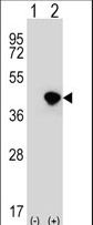 DFFA / ICAD / DFF45 Antibody - Western blot of DFFA (arrow) using rabbit polyclonal DFFA Antibody. 293 cell lysates (2 ug/lane) either nontransfected (Lane 1) or transiently transfected (Lane 2) with the DFFA gene.