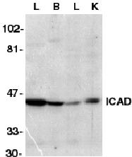 DFFA / ICAD / DFF45 Antibody - Western blot analysis of ICAD in murine lung (L), brain (B), liver (L), and kidney tissue lysate with anti-ICAD (CT) at 1ug/ml.