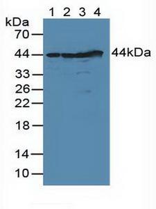 DFFA / ICAD / DFF45 Antibody - Western Blot; Sample: Lane1: Human Lung Tissue; Lane2: Human Hela Cells; Lane3: Human MCF7 Cells; Lane4: Human 293T Cells.
