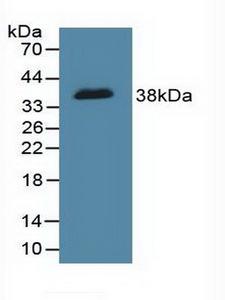 DFFA / ICAD / DFF45 Antibody - Western Blot; Sample: Recombinant DFFa, Human.