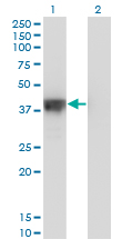 DFFA / ICAD / DFF45 Antibody - Western Blot analysis of DFFA expression in transfected 293T cell line by DFFA monoclonal antibody (M05), clone 3A11.Lane 1: DFFA transfected lysate (Predicted MW: 36.5 KDa).Lane 2: Non-transfected lysate.