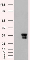 DFFA / ICAD / DFF45 Antibody - HEK293T cells were transfected with the pCMV6-ENTRY control (Left lane) or pCMV6-ENTRY DFFA (Right lane) cDNA for 48 hrs and lysed. Equivalent amounts of cell lysates (5 ug per lane) were separated by SDS-PAGE and immunoblotted with anti-DFFA.