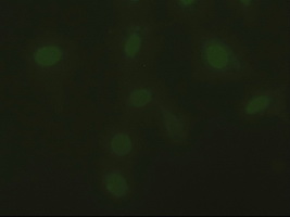 DFFA / ICAD / DFF45 Antibody - Immunofluorescent staining of HeLa cells using anti-DFFA mouse monoclonal antibody.