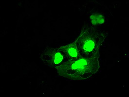 DFFA / ICAD / DFF45 Antibody - Anti-DFFA mouse monoclonal antibody immunofluorescent staining of COS7 cells transiently transfected by pCMV6-ENTRY DFFA.