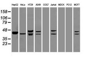 DFFA / ICAD / DFF45 Antibody - DFF45 antibody (5C4) at 1:5000 dilution + Hela cell lysate.