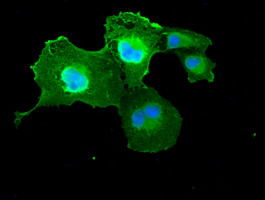 DFFA / ICAD / DFF45 Antibody - Anti-DFFA mouse monoclonal antibody  immunofluorescent staining of COS7 cells transiently transfected by pCMV6-ENTRY DFFA.