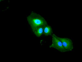 DFFA / ICAD / DFF45 Antibody - Immunofluorescent staining of A549 cells using anti-DFFA mouse monoclonal antibody.