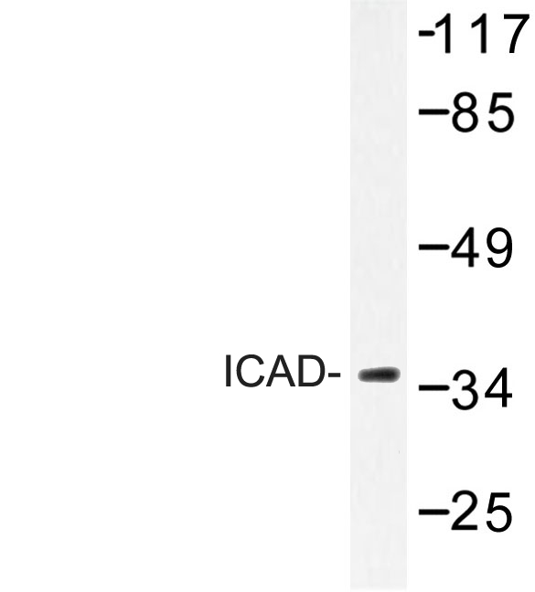 DFFA / ICAD / DFF45 Antibody - Western blot of ICAD (Q177) pAb in extracts from Jurkat cells.