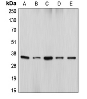 DFFA / ICAD / DFF45 Antibody - Western blot analysis of DFF45 expression in HeLa (A); U937 (B); WR19L (C); HEK293T (D); Jurkat (E) whole cell lysates.