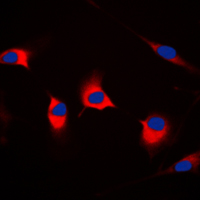 DFFA / ICAD / DFF45 Antibody - Immunofluorescent analysis of DFF45 staining in HeLa cells. Formalin-fixed cells were permeabilized with 0.1% Triton X-100 in TBS for 5-10 minutes and blocked with 3% BSA-PBS for 30 minutes at room temperature. Cells were probed with the primary antibody in 3% BSA-PBS and incubated overnight at 4 C in a humidified chamber. Cells were washed with PBST and incubated with a DyLight 594-conjugated secondary antibody (red) in PBS at room temperature in the dark. DAPI was used to stain the cell nuclei (blue).