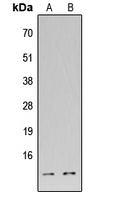 DFFA / ICAD / DFF45 Antibody - Western blot analysis of DFF45 expression in HEK293T (A); H9C2 (B) whole cell lysates.