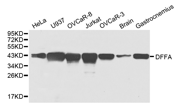 DFFA / ICAD / DFF45 Antibody - Western blot analysis of extracts of various cell lines.