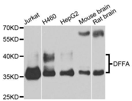 DFFA / ICAD / DFF45 Antibody - Western blot analysis of extracts of various cell lines, using DFFA antibody at 1:1000 dilution. The secondary antibody used was an HRP Goat Anti-Rabbit IgG (H+L) at 1:10000 dilution. Lysates were loaded 25ug per lane and 3% nonfat dry milk in TBST was used for blocking. An ECL Kit was used for detection and the exposure time was 15s.
