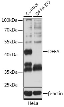 DFFA / ICAD / DFF45 Antibody - Western blot analysis of extracts from normal (control) and DFFA knockout (KO) HeLa cells, using DFFA antibodyat 1:3000 dilution. The secondary antibody used was an HRP Goat Anti-Rabbit IgG (H+L) at 1:10000 dilution. Lysates were loaded 25ug per lane and 3% nonfat dry milk in TBST was used for blocking. An ECL Kit was used for detection and the exposure time was 5s.