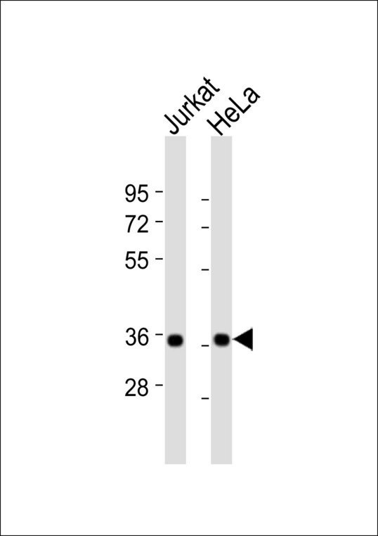DFFA / ICAD / DFF45 Antibody - All lanes : Anti-DFF45 Antibody at 1:1000 dilution Lane 1: Jurkat whole cell lysates Lane 2: HeLa whole cell lysates Lysates/proteins at 20 ug per lane. Secondary Goat Anti-Rabbit IgG, (H+L),Peroxidase conjugated at 1/10000 dilution Predicted band size : 37 kDa Blocking/Dilution buffer: 5% NFDM/TBST.
