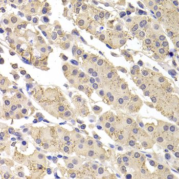 DFFA / ICAD / DFF45 Antibody - Immunohistochemistry of paraffin-embedded human stomach using DFFA antibody at dilution of 1:100 (40x lens).