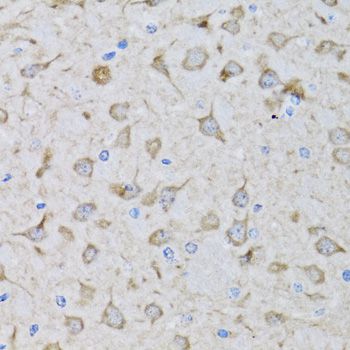 DFFA / ICAD / DFF45 Antibody - Immunohistochemistry of paraffin-embedded mouse brain using DFFA antibody at dilution of 1:100 (40x lens).