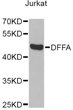 DFFA / ICAD / DFF45 Antibody - Western blot analysis of extracts of Jurkat cells, using DFFA Antibody at 1:1000 dilution. The secondary antibody used was an HRP Goat Anti-Rabbit IgG (H+L) at 1:10000 dilution. Lysates were loaded 25ug per lane and 3% nonfat dry milk in TBST was used for blocking. An ECL Kit was used for detection and the exposure time was 15s.