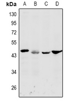 DFFA / ICAD / DFF45 Antibody - Western blot analysis of DFF45 expression in MCF7 (A), A549 (B), H9C2 (C), CT26 (D) whole cell lysates.
