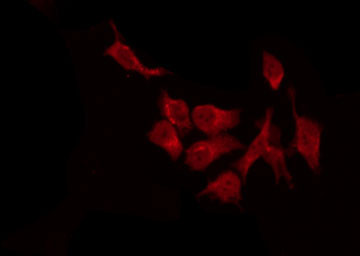 DFFA / ICAD / DFF45 Antibody - Staining HeLa cells by IF/ICC. The samples were fixed with PFA and permeabilized in 0.1% Triton X-100, then blocked in 10% serum for 45 min at 25°C. The primary antibody was diluted at 1:200 and incubated with the sample for 1 hour at 37°C. An Alexa Fluor 594 conjugated goat anti-rabbit IgG (H+L) Ab, diluted at 1/600, was used as the secondary antibody.
