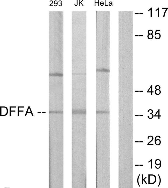 DFFA / ICAD / DFF45 Antibody - Western blot analysis of extracts from 293 cells, Jurkat cells and HeLa cells, using DFF-45 antibody.