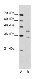DFFA / ICAD / DFF45 Antibody - A: Marker, B. Jurkat Cell Lysate.  This image was taken for the unconjugated form of this product. Other forms have not been tested.