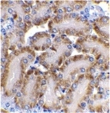DFFB Antibody - IHC of mouse kidney with Rabbit anti-Mouse CAD (RABBIT ANTI MOUSE CAD (aa205-222)).