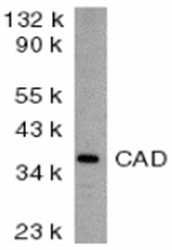 DFFB Antibody - Western blot of mouse kidney lysate probed with Rabbit anti-Mouse CAD (RABBIT ANTI MOUSE CAD (aa205-222)).