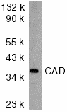DFFB Antibody - Western blot analysis of CAD in mouse kidney tissue lysate with CAD antibody at 2µg/ml.