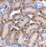 DFFB Antibody - Immunohistochemical staining of CAD in mouse kidney tissue with CAD antibody at 2µg/ml.