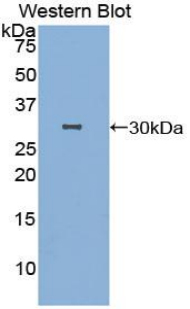DFFB Antibody - Western blot of recombinant DFF40 / DFFB.  This image was taken for the unconjugated form of this product. Other forms have not been tested.