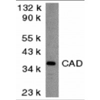 DFFB Antibody - Western blot analysis of CAD in mouse kidney tissue lysate with CAD antibody at 2 µg/mL.