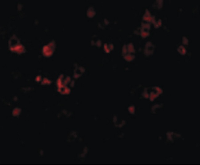 DFFB Antibody - Immunofluorescence of CAD in Mouse Kidney cells with CAD antibody at 10 ug/ml.